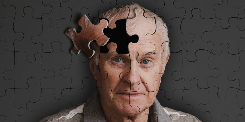 Hafıza Kaybı ve Kişilik Değişimi Alzheimer’ın Habercisi Olabilir