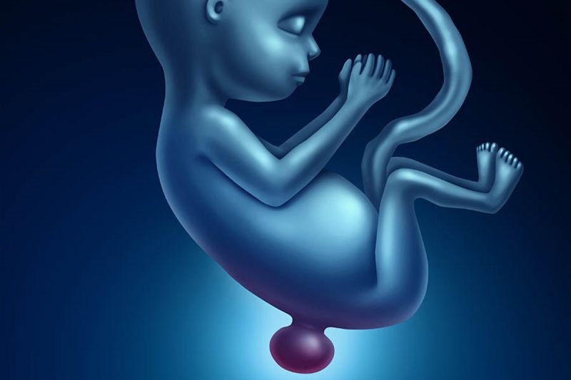 Spina Bifida Ameliyatı