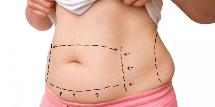 Uzmanından "liposuction" hakkında doğru bilinen yanlışlar