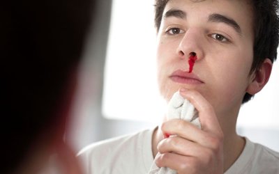 Sıcak havalarda burun kanamaları nedenlerine dikkat!