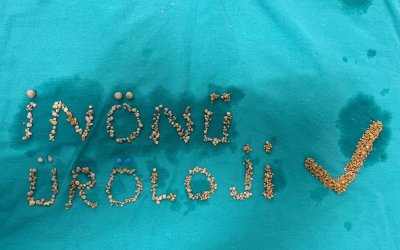 Ameliyattan hatıra: çıkan taşlarla imza attılar