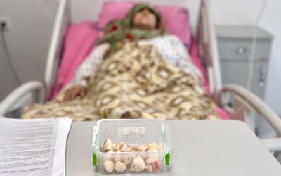 15 Yıl Diz Ağrısı Çekti, Dizinden 24 Taşlaşmış Tümör Çıktı