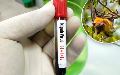 DSÖ: Nipah virüsü yüzde 75 ölüm oranına sahip ve bu oran Covid-19'un 5 katı