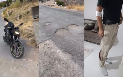 Yol Değil Tuzak: Çukura Giren Motosikletli Kaza Yaptı