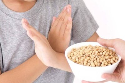 Çocuklarda besin alerjisi 2-3 kat arttı!