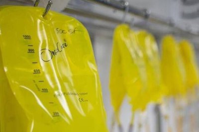 Sağlık Bakanlığından "sarı serum" açıklaması